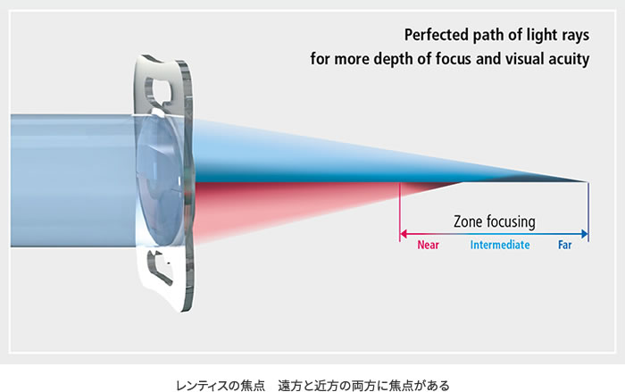 レンティス